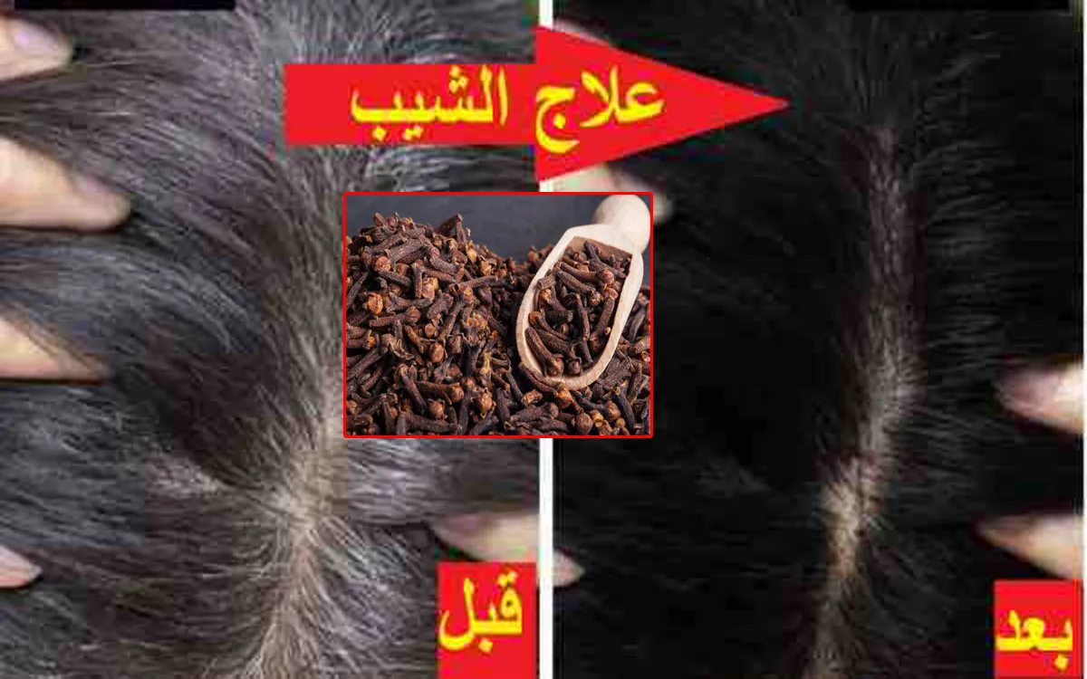 وصفة القرنفل للتخلص من الشيب