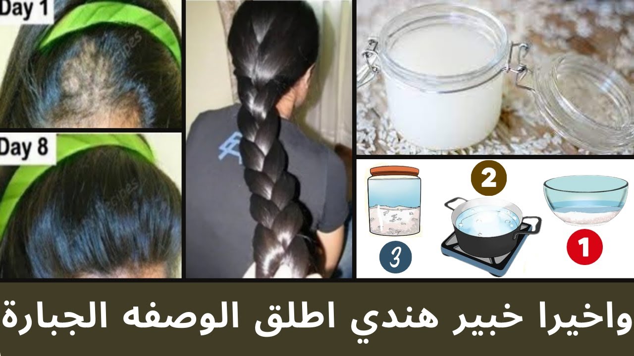 "الي يشوف شعرك مش هيصدق".. وصفة جبارة لتطويل الشعر شبر كامل في شهر واحد فقط 5 “الي يشوف شعرك مش هيصدق”.. وصفة جبارة لتطويل الشعر شبر كامل في شهر واحد فقط
