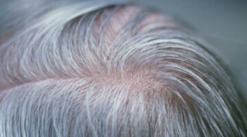 160301181355 grey hair gene 640x360 spl nocredit