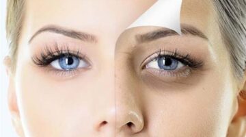 176 172046 causes methods getting rid dark circles under eyes 2