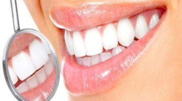 206 121443 173 222056 natural recipes teeth whitening charcoal 2