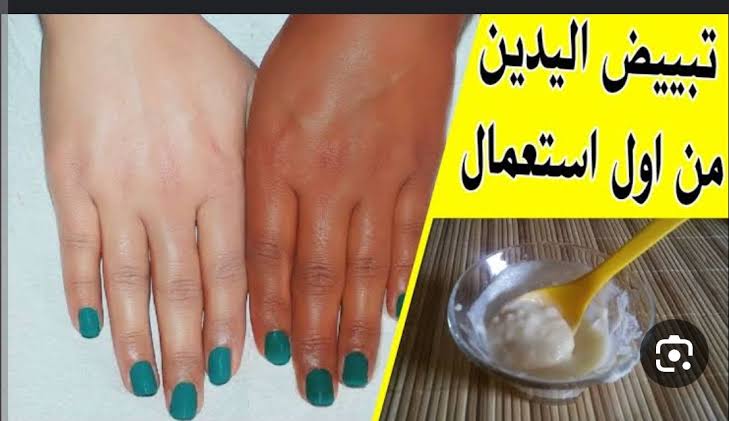 وصفة طبيعية وفعالة لتفتيح اليدين اكتشفي السر وراء يدين مشرقتين وجميلتين