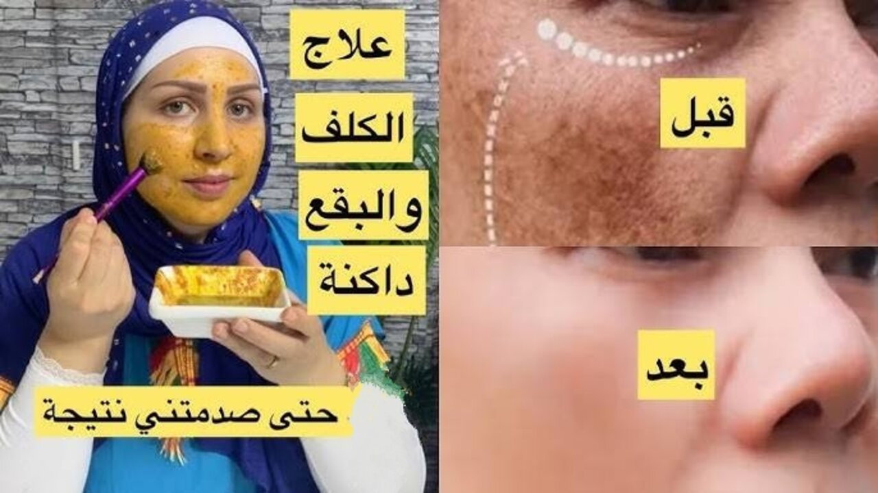روتين العروسة..وصفة الكركم والنشا لتفتيح البشرة جسمك هينور زي نجوم هليوود 2 روتين العروسة..وصفة الكركم والنشا لتفتيح البشرة جسمك هينور زي نجوم هليوود