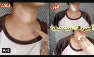 « النتيجة خيالية اقسم بالله هتبقى أحلى واحدة في أصحابك » أفضل الوصفات الطبيعية لتفتيح البشرة