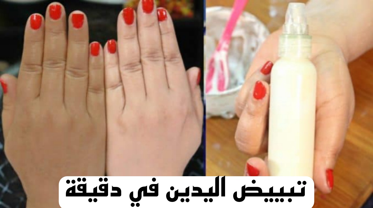 جربيها وهتنبهري..طريقة تبييض اليدين في دقيقة هتشوفي النتيجة بنفسك 5 جربيها وهتنبهري..طريقة تبييض اليدين في دقيقة هتشوفي النتيجة بنفسك