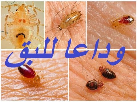 برشة واحدة القضاء على حشرة بق الفراش المنزلية نهائي بدون مبيدات ولا كيماويات 5 برشة واحدة القضاء على حشرة بق الفراش المنزلية نهائي بدون مبيدات ولا كيماويات