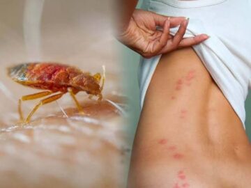 القضاء على بق الفراش وطرده فورا من المنزل بطريقه جهنميه وبدون كيماويات