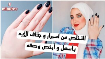 وصفة سحرية.. مقشر تبييض اليدين وازالة السواد والاسمرار هيخليكي زي القمر