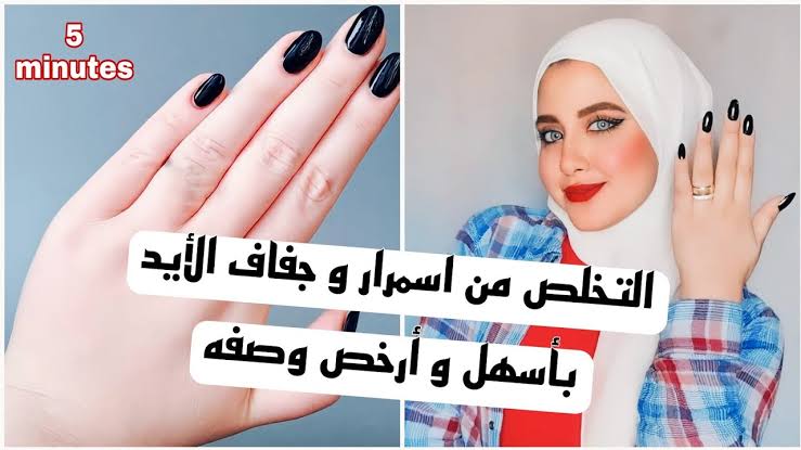 هتبقي زي العرايس.. وصفة صاروخية لتبييض اليدين من إسمرار الشمس في ربع ساعة والتخلص من التشققات والتجاعيد نهائيا 5 هتبقي زي العرايس.. وصفة صاروخية لتبييض اليدين من إسمرار الشمس في ربع ساعة والتخلص من التشققات والتجاعيد نهائيا