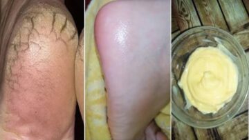 وداعا لتشققات الكعبين.. وصفة سحرية لنعومة القدمين هتبقي زي رجل الأطفال 