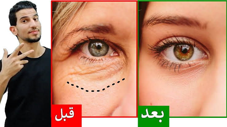 أسهل الطرق للتخلص من تجاعيد الوجه طبيعياً.. نتيجة مبهرة من أول استعمال خلال 7 أيام فقط