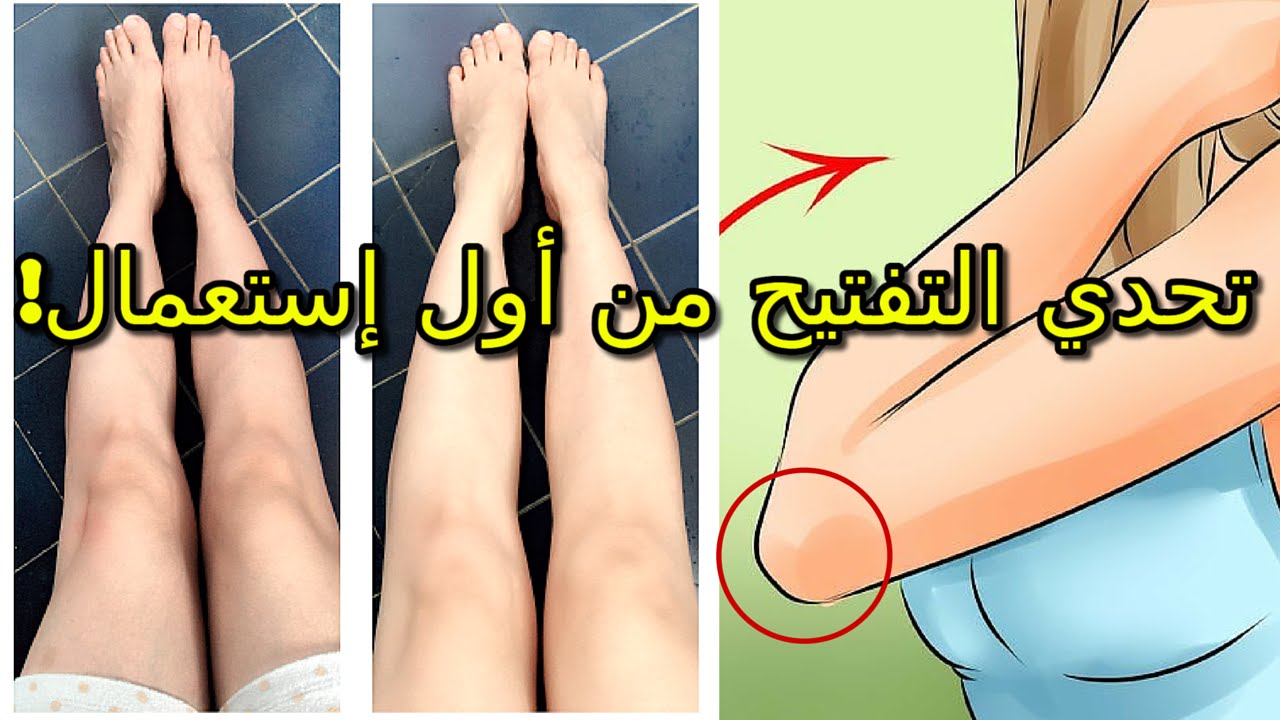 وصفة مذهلة لتفتيح وتنعيم الركب والأكواع من الاستعمال الأول 3 وصفة مذهلة لتفتيح وتنعيم الركب والأكواع من الاستعمال الأول