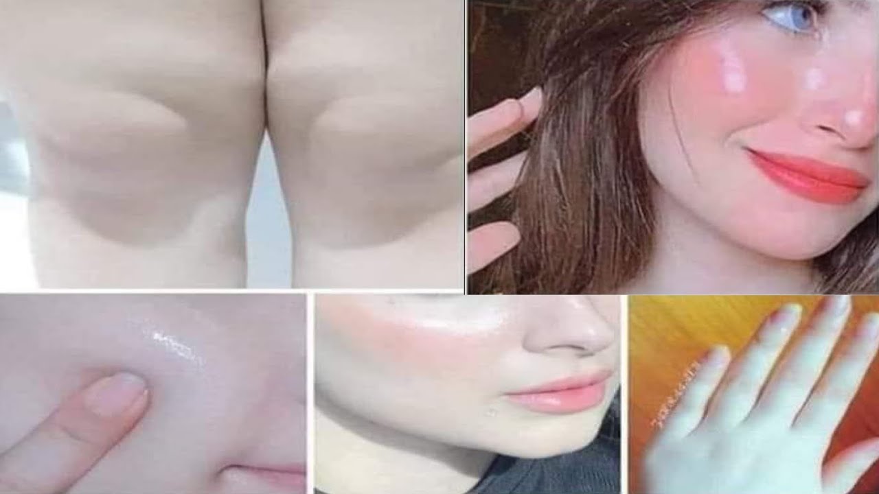 كريم سحري مبهر من الصيدلية لتفتيح البشرة بفعالية وحقيقي مناسب لأي وجه وهيجيب نتيجة 5 كريم سحري مبهر من الصيدلية لتفتيح البشرة بفعالية وحقيقي مناسب لأي وجه وهيجيب نتيجة