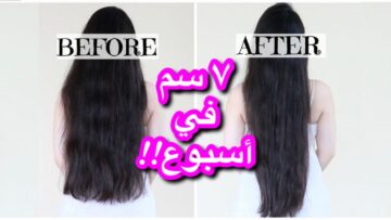 يطول الشعر بجنون كريم من الصيدلية ينمو شعرك بغزارة بدون توقف وانبات الفراغات والصلع