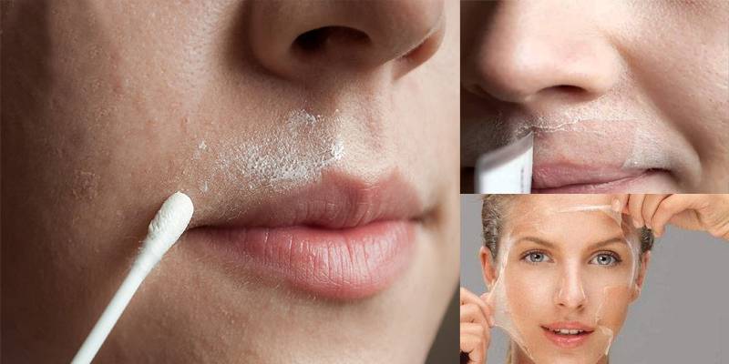 افضل طريقه لازالة شعر الوجه بدون ألم في 5 دقائق والنتيجة وجه منور وبياض دائم بدون شفرات