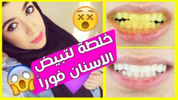 تبييض الأسنان في 5 دقائق بمواد طبيعية … أسنانك لؤلؤ من أول مرة