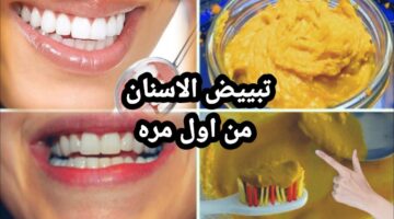 تبييض الاسنان بالكركم