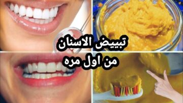أذهلت دكاترة الأسنان.. عشبة مُدهشة لتبييض الأسنان وإزالة إصفرار 20 سنة فاتوا خلال ساعتين فقط!