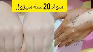 بياض الثلج.. خلطة صاروخية لتبييض اليدين وإزالة اسمرار الشمس والتجاعيد من أول يوم هتبقي زي القشطة