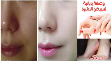 تبييض وتفتيح الوجه وإزالة البقع