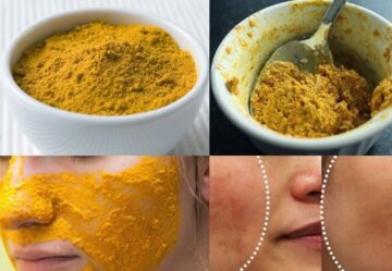 لو  انتي عروسة.. طريقة عمل دلكة النشا والكركم لتفتيح الجسم والتخلص من اسمرار الركب والأكواع