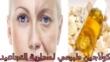 أقوى كولاجين طبيعي سيروم لبان الذكر لشد البشرة والترهلات