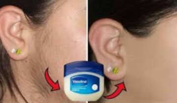  وصفات الفازلين لإزالة شعر الوجه والجسم بثلاث وصفات منزلية لبشرة ناعمة