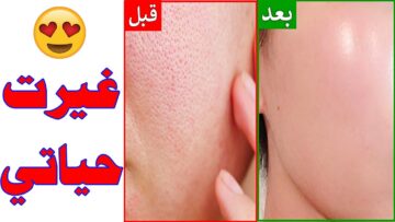 طريقة عمل غسول للبشرة الدهنية وإزالة الخلايا الميتة والدهون الزائدة في دقائق
