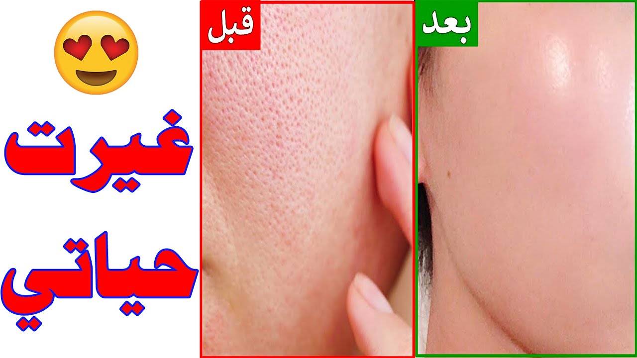 طريقة عمل غسول للبشرة الدهنية وإزالة الخلايا الميتة والدهون الزائدة في دقائق