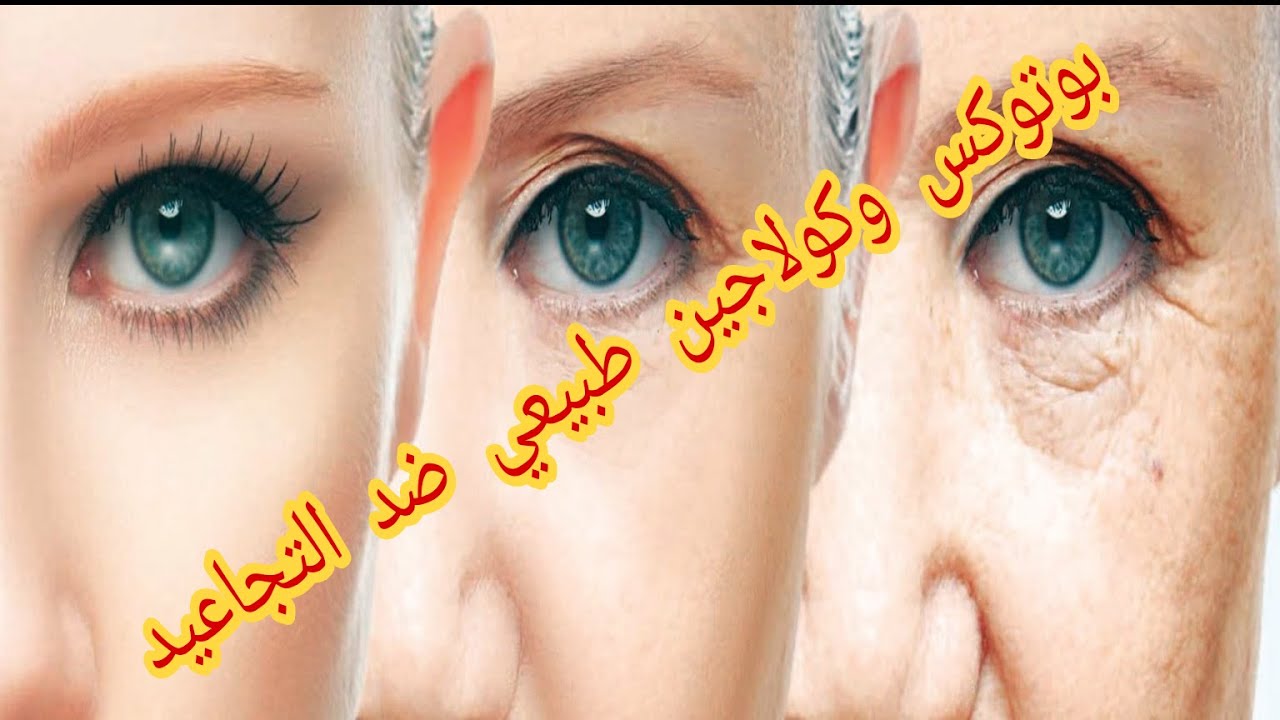 طريقة عمل ماسك لبان الذكر لتفتيح الوجه وازاله التجاعيد 5 طريقة عمل ماسك لبان الذكر لتفتيح الوجه وازاله التجاعيد