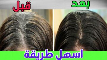 التخلص من الشعر الأبيض نهائي علاج الشيب بالخميرة وصفة سحرية