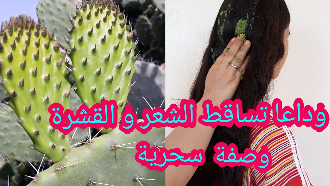 ماسك جل الصبار لوقف تساقط الشعر بفوائده شعرك هيكون كثيف وصحي 5 ماسك جل الصبار لوقف تساقط الشعر بفوائده شعرك هيكون كثيف وصحي