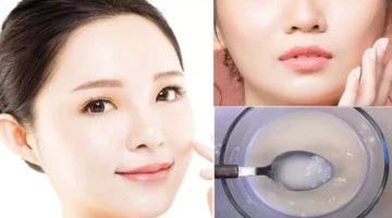 ماسكات لحروق الشمس وتبيض الوجه