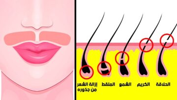 “من جدوره” وصفة إزالة شعر الوجه بمكونات طبيعية لبشرة ناعمة بديل الليزر السحري