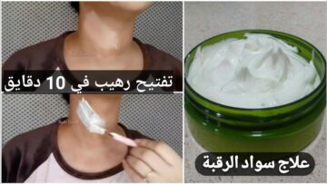 “رقبتك هتنور” وصفة تبييض الرقبة بـ 3 وصفات منزلية هتجيب من الآخر