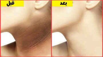 وصفة تبييض الرقبة في ربع ساعة فقط