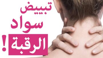 بمكونات طبيعية وآمنة.. وصفة طبيعية لتفتيح الرقبة من الاسمرار وتفتيح كل منطقة مسودة بسرعة