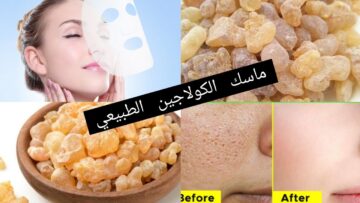 كولاجين طبيعي للبشرة للتخلص من التجاعيد والانكماش تماماً وهيشد بشرتك أحسن من الفيلر