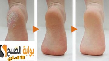 ١٧٠٠٥٩٠١٨٣٠٣٠