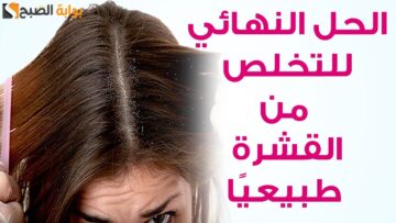 وليه توقعيه لما ممكن تعالجيه.. وصفة طبيعية لعلاج القشرة الموجودة في الشعر مع تقليل التساقط والحكة ” النتيجة مضمونة من اول استخدام”