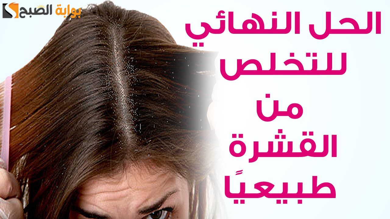 وليه توقعيه لما ممكن تعالجيه.. وصفة طبيعية لعلاج القشرة الموجودة في الشعر مع تقليل التساقط والحكة " النتيجة مضمونة من اول استخدام" 5 وليه توقعيه لما ممكن تعالجيه.. وصفة طبيعية لعلاج القشرة الموجودة في الشعر مع تقليل التساقط والحكة ” النتيجة مضمونة من اول استخدام”