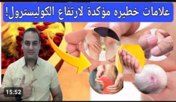 هتموت في لمح البصر .. اخطر طعام يتسبب في ارتفاع الكوليسترول  ..  خطير للغاية ابتعد عنه فوراً وخلي بالك