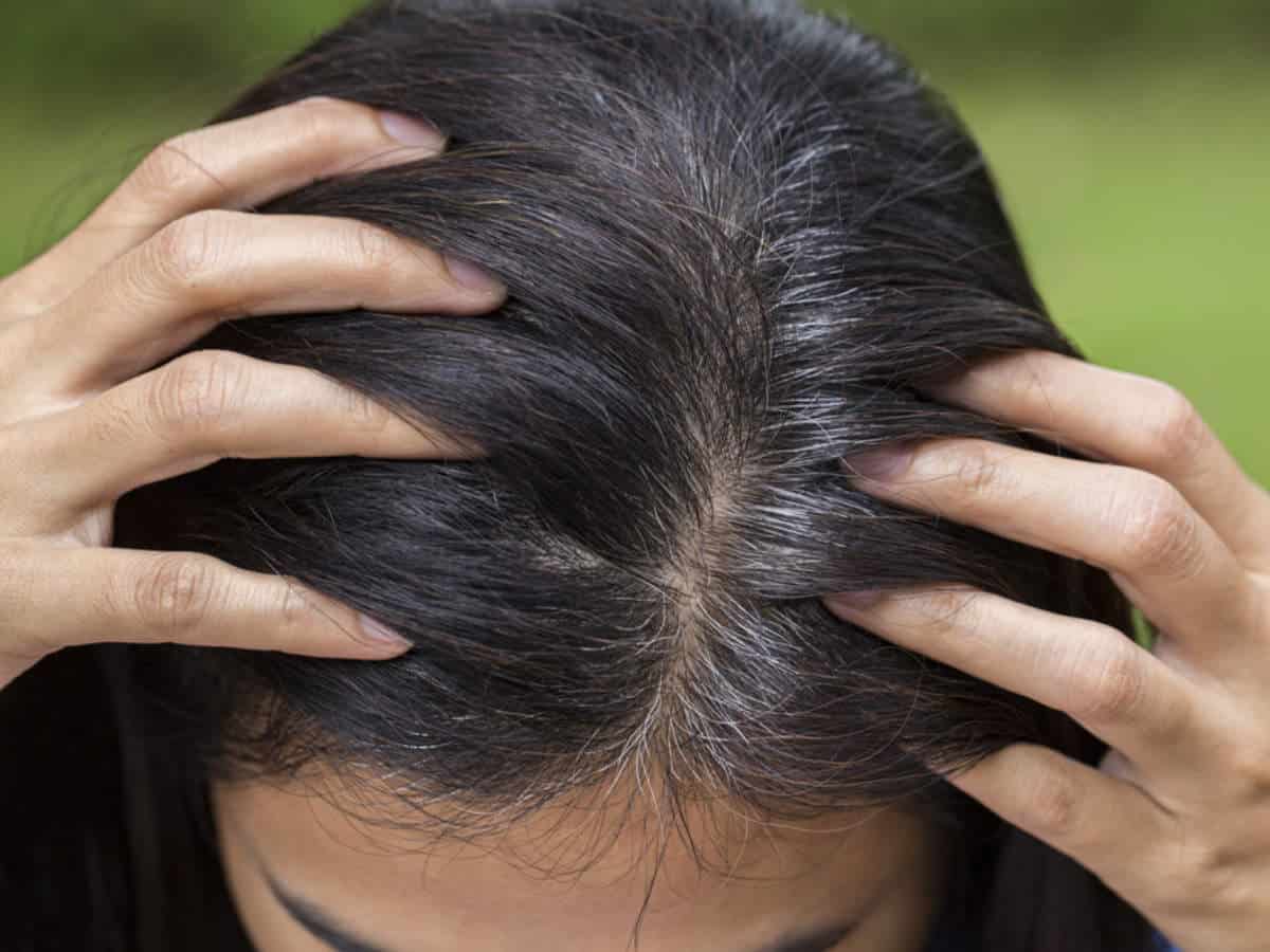 بمعلقة من الفازلين تخلصي من الشيب المبكر بدون عودة انسي الشعر الأبيض