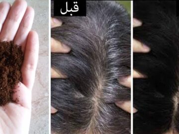 رجعي شبابك وأخفي الشعر الأبيض بخلطة القرنفل الرائعة لعلاج الشيب المبكر