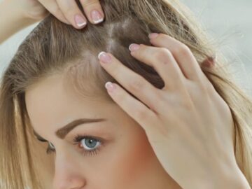 شعرك هيتحول إلي مزرعة بيبي هير بهذه الوصفة السحرية لتكثيف الشعر ووقف التساقط