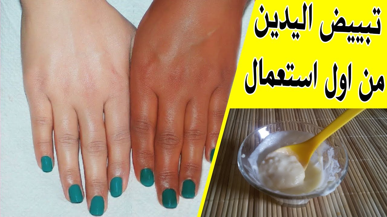 وصفة طبيعية لتفتيح اليدين من اسمرار الشمس بسرعة وبشكل نهائي