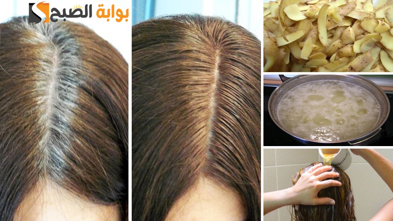كنز في بيتك وأغلى من الذهب.. وصفة قشر البطاطس هتحللك نص مشاكل شعرك '' مش هترمي القشر مرة تانية" 5 كنز في بيتك وأغلى من الذهب.. وصفة قشر البطاطس هتحللك نص مشاكل شعرك ” مش هترمي القشر مرة تانية”