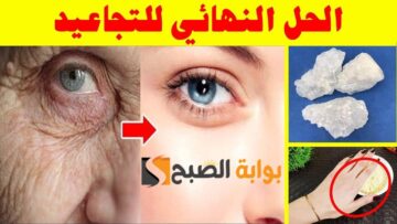 خلي الكل ينبهر بجمالك… طريقة لعمل بوتكس طبيعي في المنزل لشد البشره وفري فلوسك