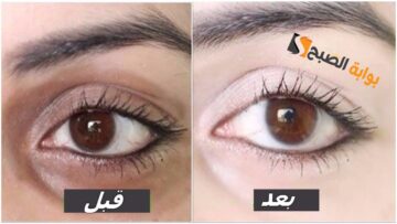 عشان منطقة أسفل العين حساسة .. أفضل الماسكات الطبيعية من النعناع لعلاج الهالات السوداء والانتفاخ أسفل العين “عيونك هتنور”
