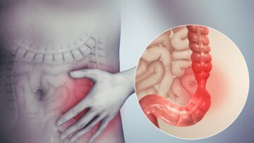 انسى آلام المعدة المتكررة.. طرق منزلية لعلاج القولون العصبي وتحجر الأمعاء وتنظيف الجسم من السموم
